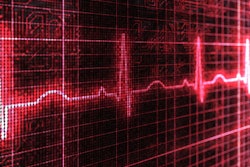 Stock_pulse_rate