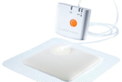 Pw 29989 Smith Nephew