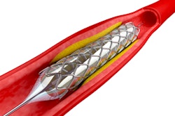 Angioplasty stent