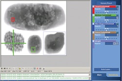 PRODUCT INSPECTION. A screenshot of Eagle’s SimulTask PRO Image “set and forget” analysis software, which facilitates changeover, reduces downtime, and imparts flexibility in the product inspection process.