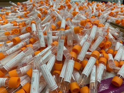 VTM tubes filled with liquid medium are used to store and transport nasal swabs for viruses including SARS-CoV-2.