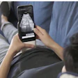 5. PulseNmore ES is an ultrasound device for home use. Credit: Good Design Awards and The Chicago Athenaeum.
