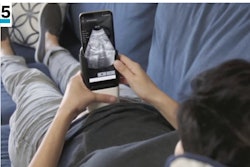 5. PulseNmore ES is an ultrasound device for home use. Credit: Good Design Awards and The Chicago Athenaeum.